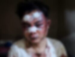 Nyaris Tewas Di Amuk Massa, Kapolsek Cigudeg Dan Unit Reskrim Gercep Berhasil Amankan Pelaku Curanmor